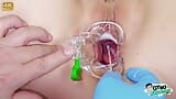 Cervical exam of chubby young blonde Cayla Lyons by 2 doctors snapshot 9