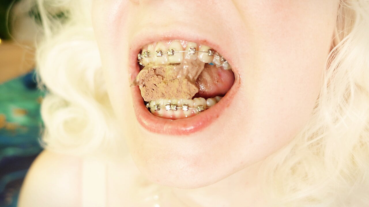 BRACES fetish – ASMR video of eating food MUKBANG…