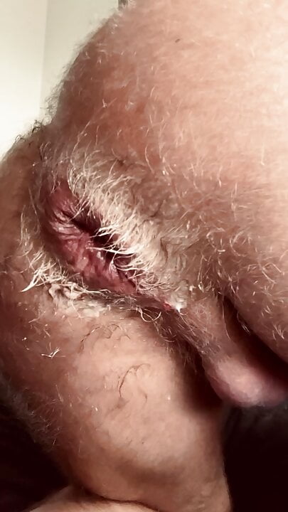 DESTROYING MY HOLE HARDCORE ANAL FIST WITH SPIT AND BOTTOOMCUM