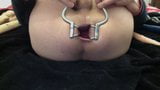 Anal Speculum 3 snapshot 4