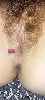 Тікелей жыныстық қатынас