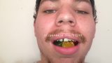 Vore Fetish - Devon Eating Gummy Bears Video 2 snapshot 5