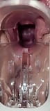 Оргазм шейки матки с камшотом с гинекологическим зеркалом snapshot 6