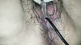 The doctor stimulates my urethra with his instruments and in the end I receive his cock in my hairy pussy snapshot 9