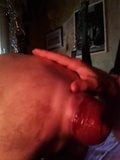 Big anal prolapse sucking. Wonderful gay cunt! snapshot 4