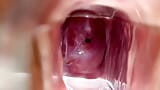 Gebärmutterhals pulsierendes und fließendes sickerndes sperma während nahaufnahme spekulöses spielen snapshot 12