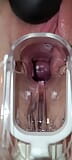 Espéculo cervix orgasmo corrida snapshot 14