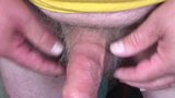 Foreskin with 6 casino chips and 1 table tennis ball snapshot 9