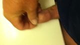 Foreskin snapshot 3