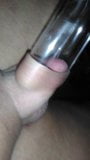 speculum stretches penis too snapshot 2