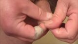 Foreskin with ice - 3 videos snapshot 8