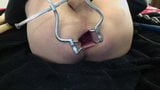 Anal Speculum 3 snapshot 12