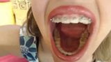 Girl's mouth snapshot 5