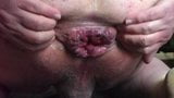 Close-up anal gape with a block of ice snapshot 5
