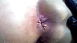 Inspection of my ass in close-up snapshot 4