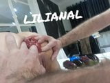 Prolapso anal snapshot 8