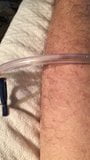 Catheter pee flow snapshot 1