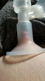 Nipple suctioned hard by breast pump snapshot 2