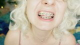 เฟติชจัดฟัน: วิดีโอ asmr ของการกิน mukbang snapshot 9