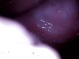 Vagina endoscope snapshot 9