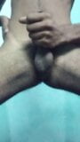 Phimosis penis onani - het och sexig snapshot 13