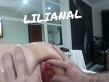 Anal Prolapso snapshot 3