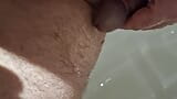 Smooth to hairy balls Part 3 snapshot 15