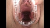 Preciosa anglosajona speculum cervix insertioon object snapshot 2