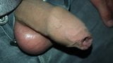 foreskin close up super snapshot 3