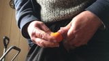 Orange fruit in foreskin snapshot 2