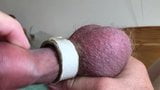 Foreskin with rubber egg snapshot 9
