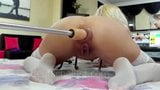 German mature has extreme anal prolapse snapshot 3