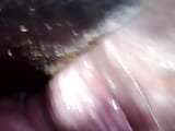 Vagina endoscope snapshot 8