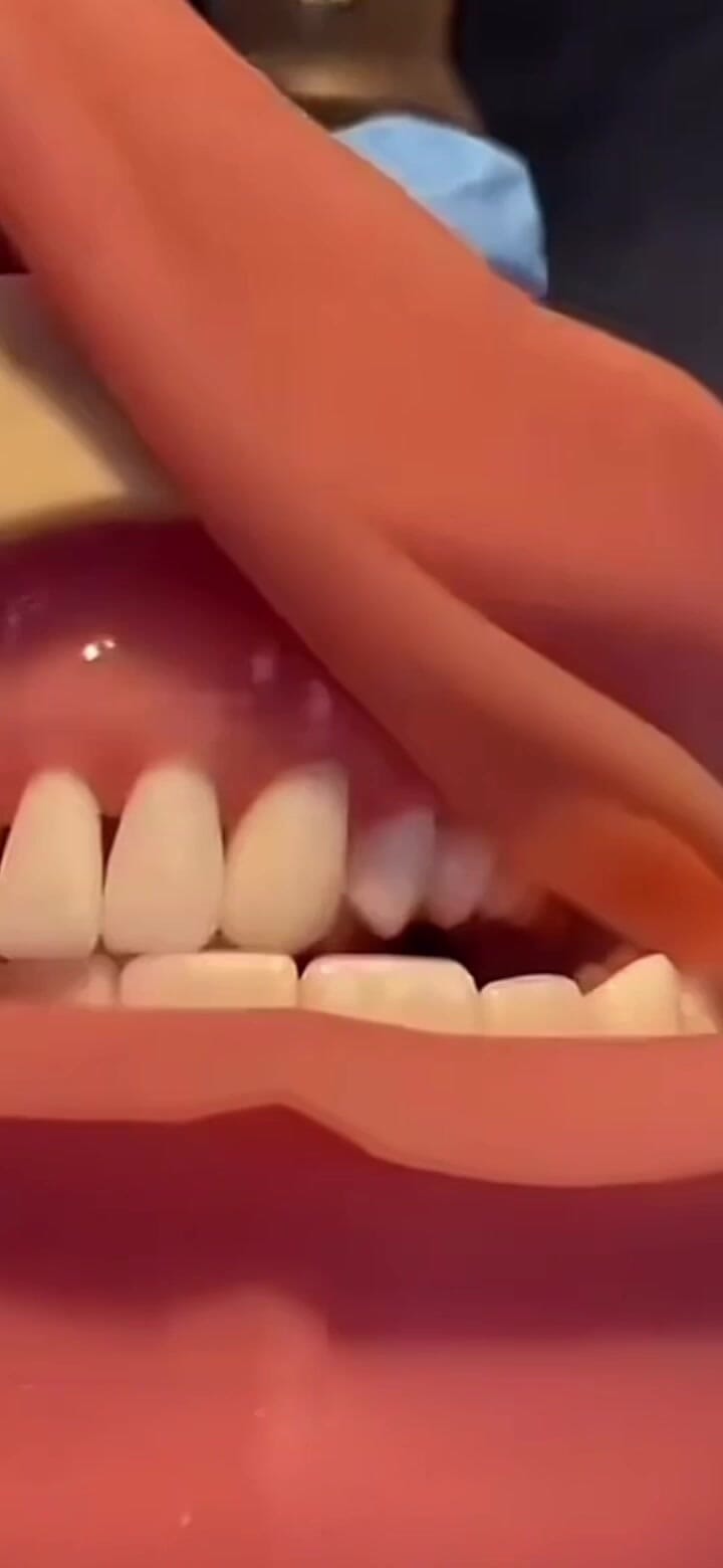 MOUTH FETISH