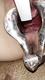 Urethral stapler snapshot 11