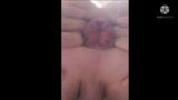 Huge Anal dilator with massive gape and nice Prolapse ending snapshot 19