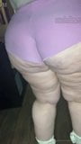 Cellulitis pawg 1 snapshot 13