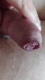 Foreskin cum snapshot 1