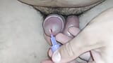 insertion of the pointed reamer into the dick channel. snapshot 15