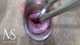 Maya Simons OPENING HER CERVIX (EXTREME) snapshot 8