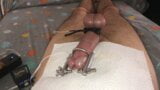 E-stim with urethral stretcher snapshot 3