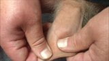 Batteries in foreskin - 5 videos snapshot 3