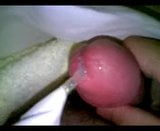 Hôpital en masturbation snapshot 11