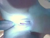 Trío anal casero snapshot 3