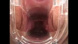 Preciosa anglosajona speculum cervix insertioon object snapshot 3