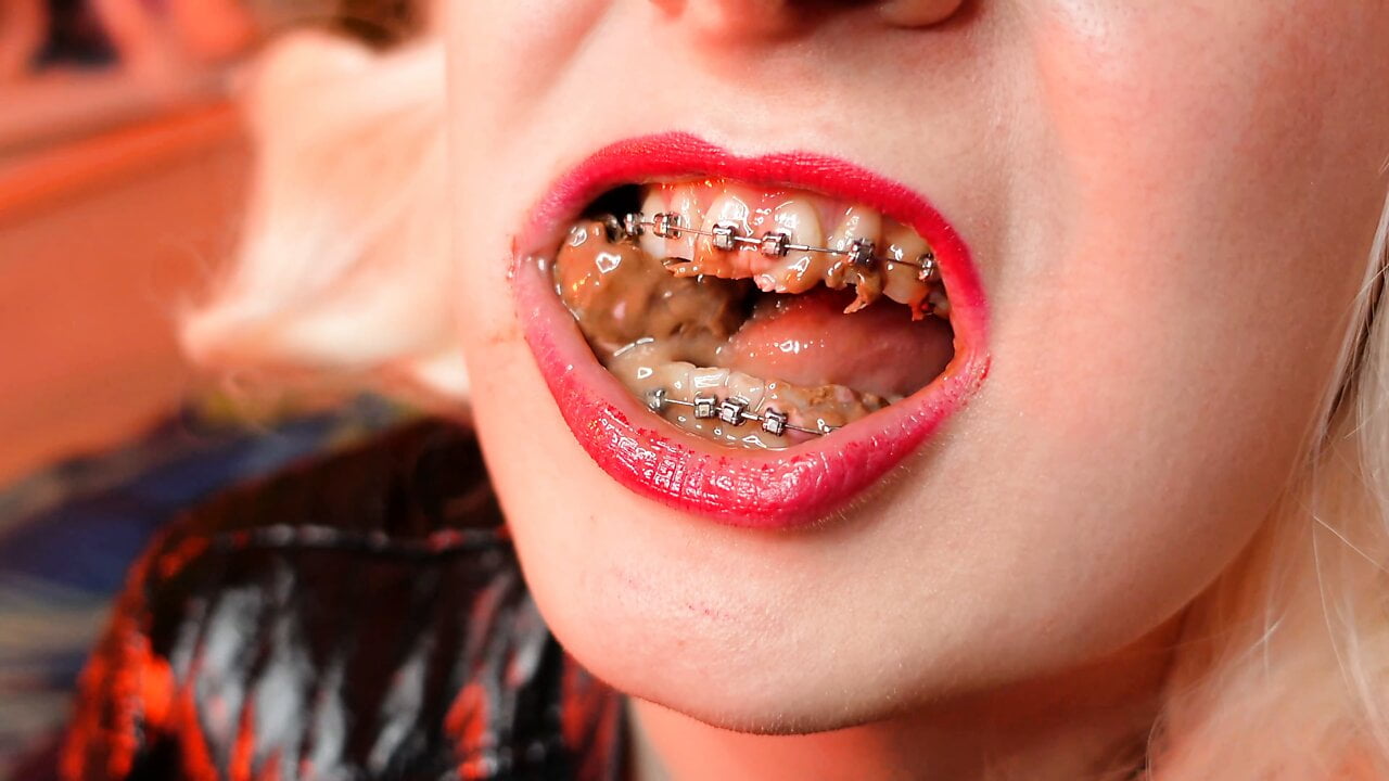 ASMR mukbang FOOD FETISH eating video close up with BRACES