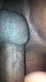 NASTY BLACK BALLS HANGING OUT FROM PUSPUS snapshot 1