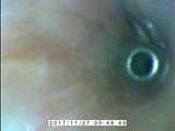 Endoscope E-stim inside Cumming.AVI snapshot 11