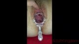Pussy gets fisted and opened with a speculum snapshot 4