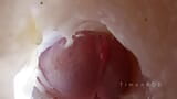 A vulgar guy found a way to find out what is happening inside the anus during sex snapshot 5